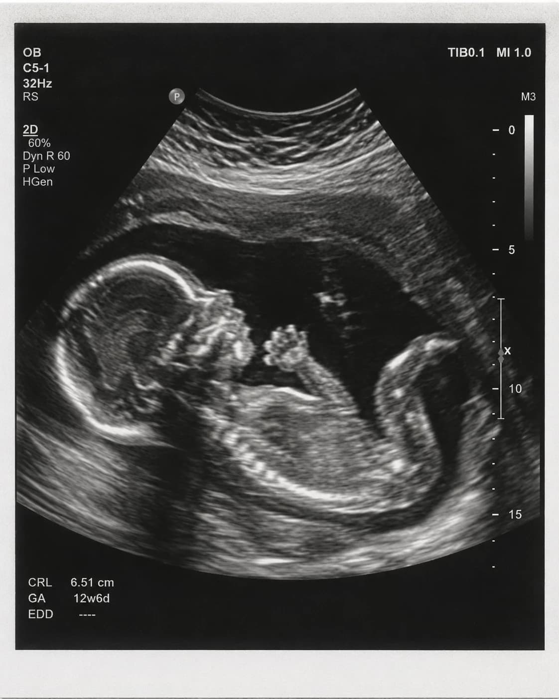 Illustrative sonogram artwork for the Baby Cusano announcement